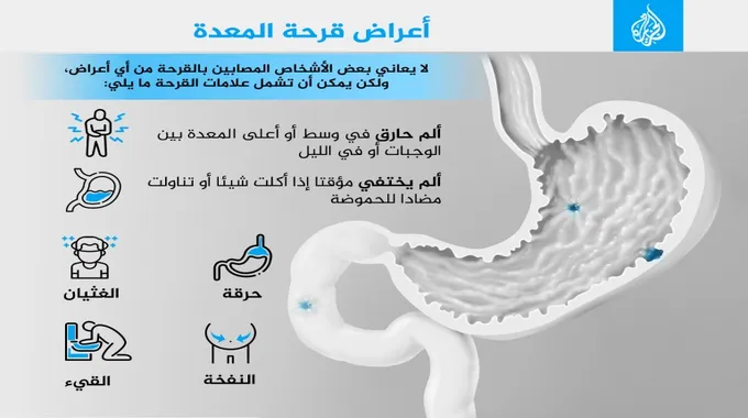 أعراض سرطان المعدة عند الأطفال وعلاجه